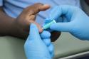 Foto de uma mão sendo picada com uma pequena agulha pela mão de  uma profissional de saúde, para retirar uma gota de sangue para o teste rapido para hepatite C, B, ou sífilis ou HIV/aids. . 
