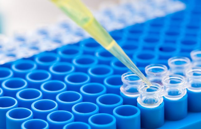 pipetagem